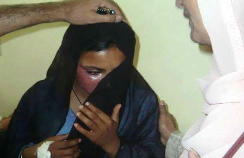 पाकिस्तान में मुस्लिम युवक के शादी का प्रस्ताव ठुकराने पर ईसाई युवती को जिंदा जला दिया गया। (फोटो सोर्स: ट्विटर) 