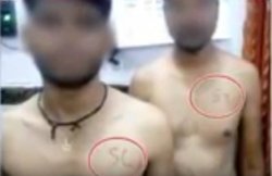मध्य प्रदेश में सरकारी नौकरी का मेडिकल टेस्ट, अभ्यर्थियों के सीने पर SC/ST लिख किया अलग