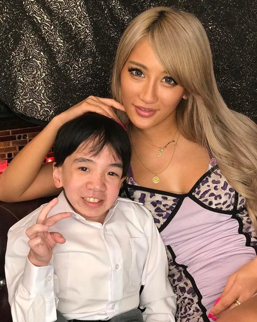 Japanese porn star, child porn star, Nishikun, Kohey Nishi, Mucopolysaccharidosis, weird news, news update, porn news