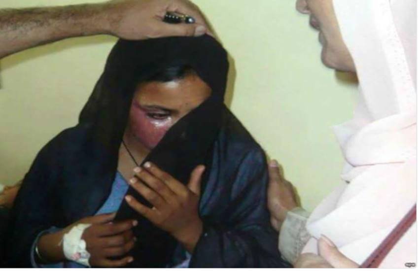 बुरी तरह झुलसने की वजह से आसमा याकूब की मौत हो गई। 