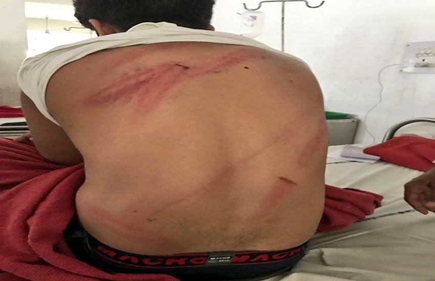मध्य प्रदेश में फेसबुक पोस्ट लिखने पर कांग्रेसी नेता दीपक विश्वकर्मा पर हुआ हमला।