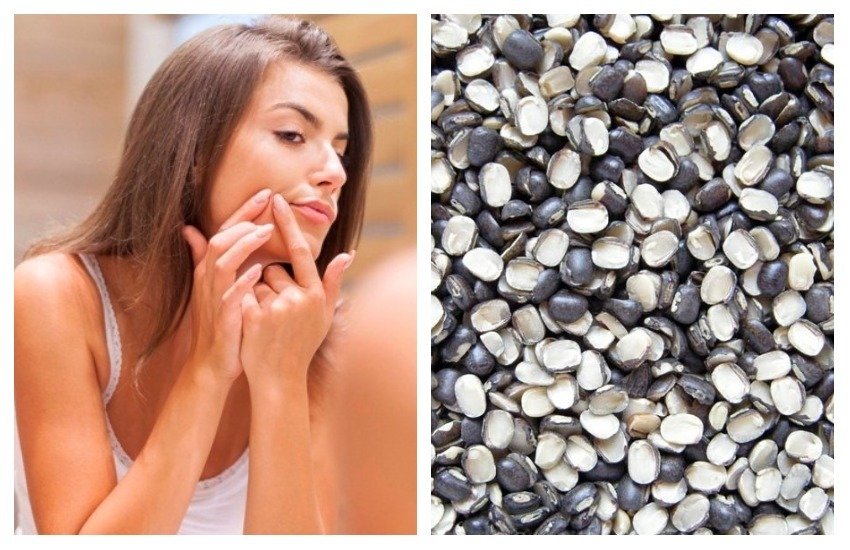 Urad daal, Urad daal for skin, skin problems, pimples, scars, sunburn, skin tone, Urad daal for glowing skin, Urad daal for skin problems, pulse, Urad pulse, home remedies, natural treatments, health news in hindi, health tips in hindi, lifestyle news in hindi, jansatta
