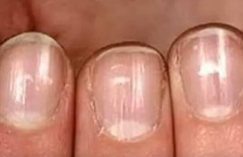 Nails, Nails facts, Nails benefits, Nails and religion, Nails unknown facts, Nails signs, Nails and astrology, Nails says, Nails mark, White Mark, White Mark on nail, White Mark facts, White Mark benefits, Astrology news
