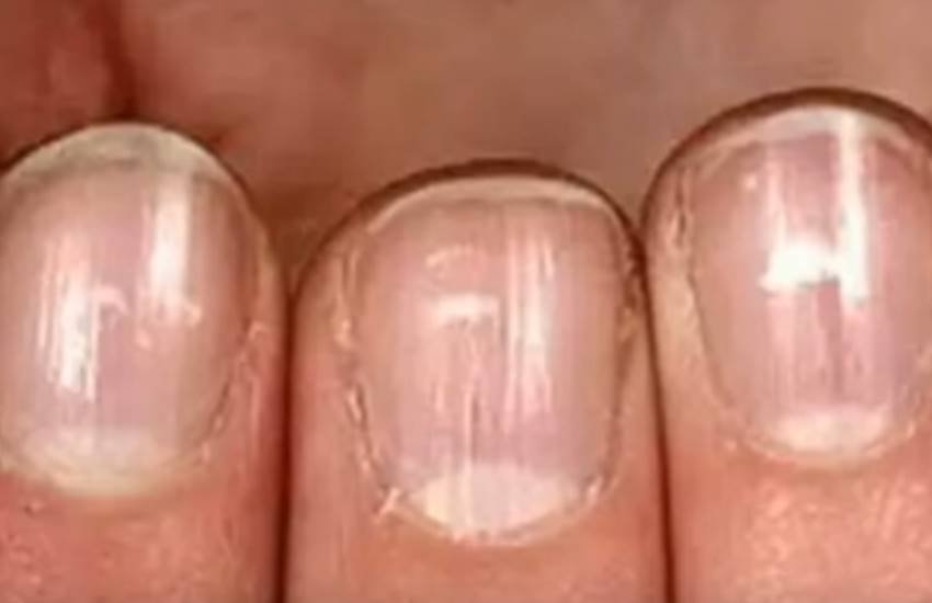 Nails, Nails facts, Nails benefits, Nails and religion, Nails unknown facts, Nails signs, Nails and astrology, Nails says, Nails mark, White Mark, White Mark on nail, White Mark facts, White Mark benefits, Astrology news