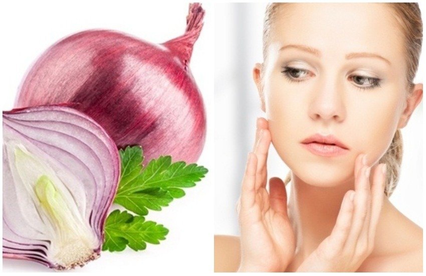 acne, pimples, skin problems, skin care tips, home remedies, home remedies for skin, anti ageing remedies, onion paste, onion face wash, onion skin uses, health tips, health tips in hindi, healthy lifestyle tips in hindi, lifestyle news in hindi, home remedies in hindi, natural remedies, healthy foods, healthy living, healthy life, lifestyle news in hindi, jansatta acne, pimples, skin problems, skin care tips, home remedies, home remedies for skin, anti ageing remedies, onion paste, onion face wash, onion skin uses, health tips, health tips in hindi, healthy lifestyle tips in hindi, lifestyle news in hindi, home remedies in hindi, natural remedies, healthy foods, healthy living, healthy life, lifestyle news in hindi, jansatta
