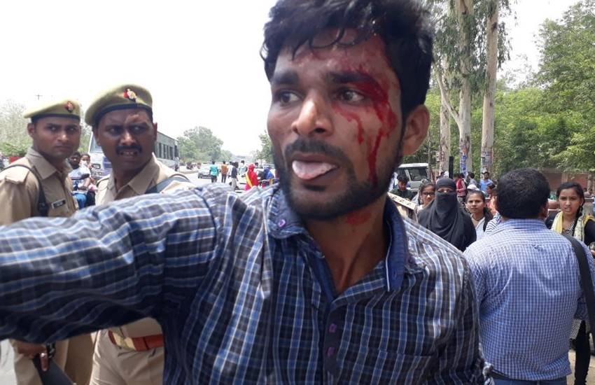 कई छात्र व छात्राएं चोटिल हो गए। घायल छात्रों को अस्पताल में भर्ती कराया गया है। कई छात्र व छात्राएं चोटिल हो गए। घायल छात्रों को अस्पताल में भर्ती कराया गया है।