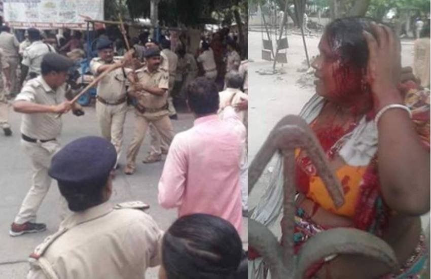 अनशन के दौरान बुजुर्ग और दुधमुहे बच्चों पर पुलिस ने लाठियां भांजीं थीं। घटना के दौरान चोटिल हुई महिला। (फोटोः फेसबुक) 