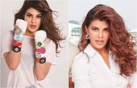 Race 3 actor, race 3 actress Jacqueline Fernandez, Jacqueline Fernandez shared a picture, Jacqueline Fernandez with her eye injury, Jacqueline Fernandez says will suffers permanent, Jacqueline Fernandez, Jacqueline Fernandez, entertainment news, bollywood news, television news, entertainment news of salman khan