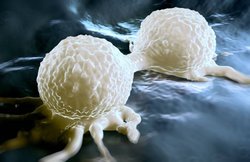 शोधः खाना खाकर तुरंत सो जाते हैं तो कैंसर को दे रहे हैं दावत