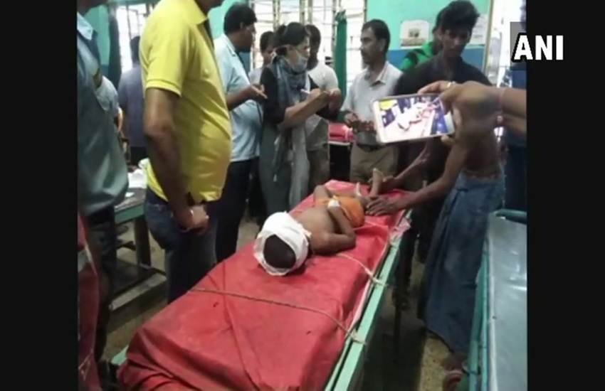 मालदा में गोली लगने के बाद घायल बच्चे का इलाज करते डॉक्टर। फोटो-एएनआई