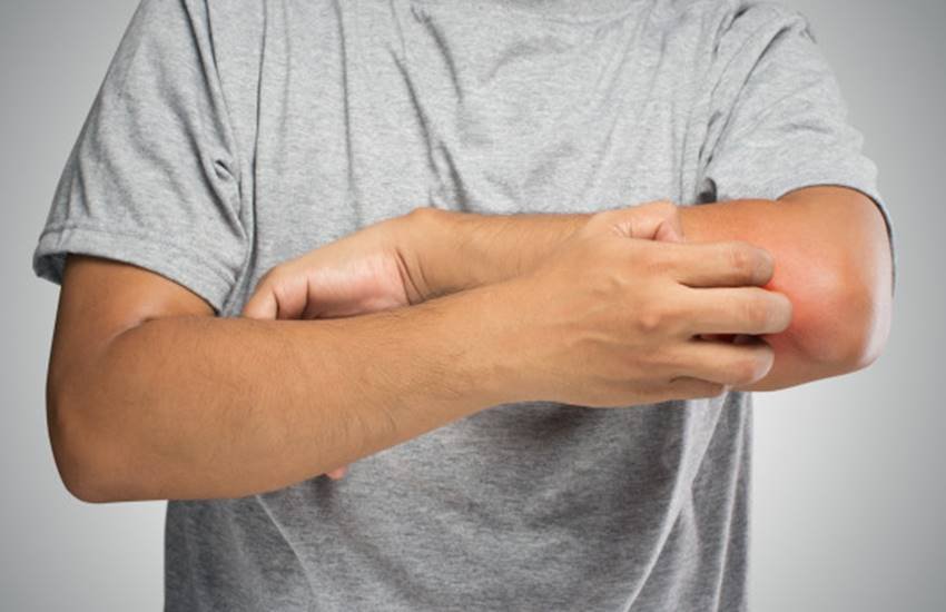 मच्छरों से बचने के लिए आप कुछ घरेलू तरीकों का इस्तेमाल कर सकते हैं।