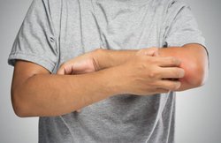 इन 4 घरेलू तरीकों से दूर भगाएं मच्छर, मॉनसून में बीमारियों से बचने के लिए ध्यान रखें ये बातें