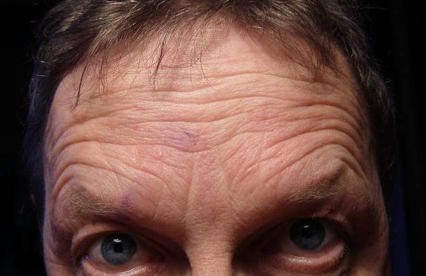 शोध के अंत में रिसर्चर्स ने बताया कि जिन लोगों में रिंकल्स का स्कोर 1 था उनमें बिना किसी रिंकल्स स्कोर वाले लोगों के मुकाबले मरने का खतरा ज्यादा था। शोध के अंत में रिसर्चर्स ने बताया कि जिन लोगों में रिंकल्स का स्कोर 1 था उनमें बिना किसी रिंकल्स स्कोर वाले लोगों के मुकाबले मरने का खतरा ज्यादा था।