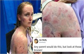 australian-mom-save-baby-hailstorm