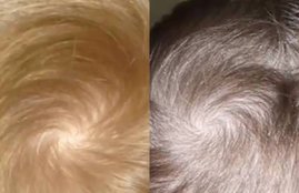 Whirls On Head, Whirls Of Head, Meaning Of Whirls, Samudra Shastra, Samudra Shastra facts, Samudra Shastra about whirls, Samudra Shastra tips, According To Samudra Shastra, religion news