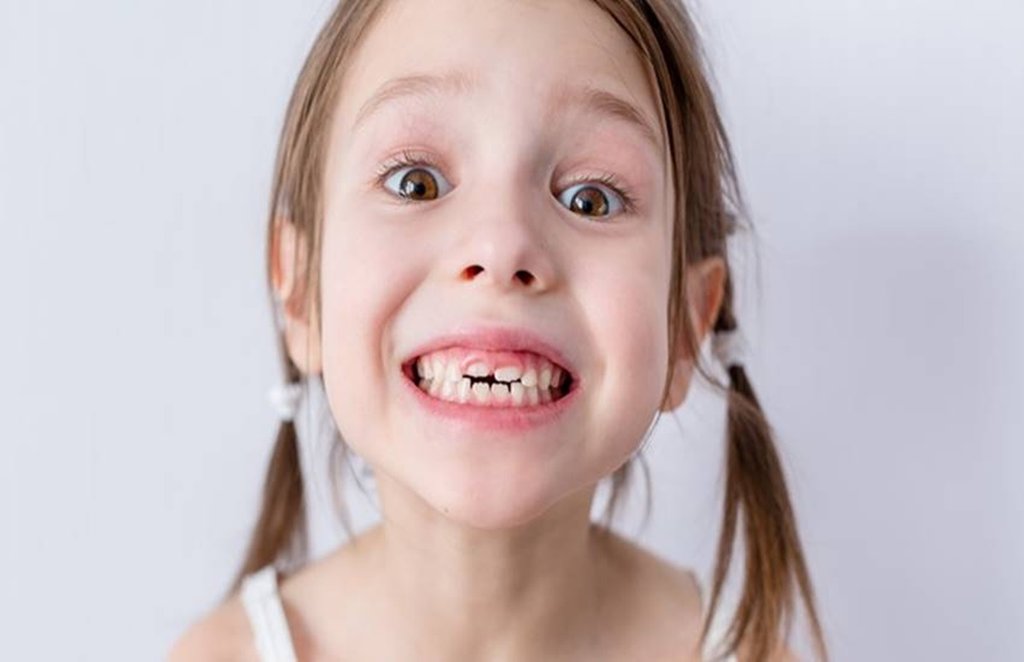 tooth fairy, parenting, children teeth, children, child broken tooth, stem cells, research, study, child health, lifestyle, fitness, workout, weight gain, weight training, health, jansatta news, jansatta