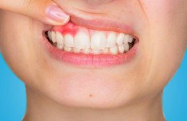 High blood pressure, High blood pressure medication, High blood pressure treatment, High blood pressure cure, High blood pressure prevention, High blood pressure effects, High blood pressure symptoms, High blood pressure news, High blood pressure latest news, High blood pressure diet, High blood pressure causes, High blood pressure medicines, tooth loss,tooth loss, tooth loss effects, tooth loss impacts, tooth loss old age, tooth loss blood pressure, tooth loss treatment, tooth loss disease, tooth loss chart, tooth loss problems, health, health news, hindi news, news in hindi, jansatta