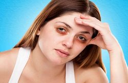 आंखों के पास डार्क सर्कल से रहना है दूर तो इन बातों का जरूर रखें ध्यान