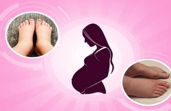 प्रेग्नेंसी के दौरान पैरों और एड़ियों में आ जाती है सूजन, कम करने का जानें उपाय