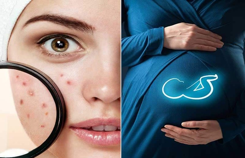 प्रेग्नेंसी के दौरान त्वचा की देखभाल करें (Source: Dreamstime)