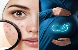 प्रेग्नेंसी के दौरान भी नहीं जाएगी त्वचा की चमक, इस तरह रखें ख्याल