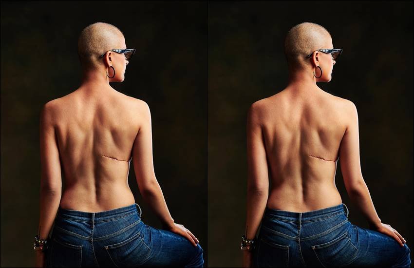 world cancer day, world cancer day 2019, world cancer day post, tahira kashyap, ayushman khurana's wife, tahira kashyap wife of ayushman khurana, sonali bendre, Goldi behl