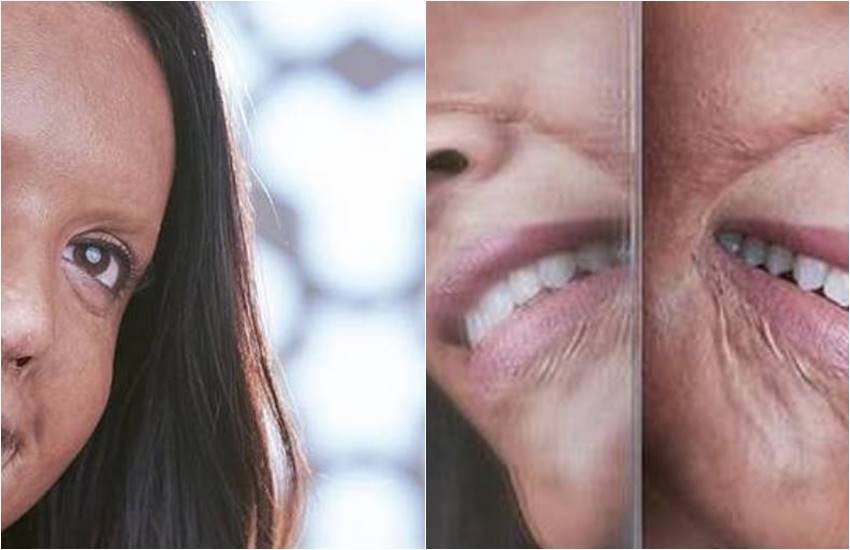 chhapaak first look poster, Deepika Padukone, chhapaak, first look poster of Deepika Padukone, Chhapaak actress Deepika Padukone, actress Deepika Padukone, Deepika Padukone Playing Acid attack survivor character, Deepika Padukone as malti IN CHHAPAAK, ENTERTAINMNET NEWS, bollywood news, television news, entertainment news