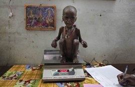 Malnutrition, Highest Rate, Worst Performers, Stunting, Varanasi, BJP, Narendra Modi, Congress, Rahul Gandhi, Amethi, Mallikarjun Khadge, Gulbarg, Parliamentary Constituencies, India, National News, India News, Hindi News