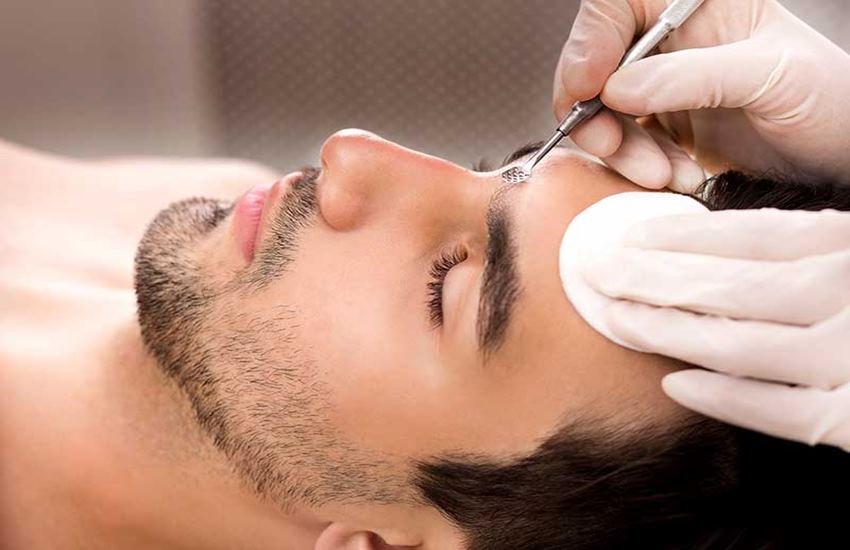 ब्लैकहेड्स दूर करने के लिए टिप्स (Source: Dreamstime)
