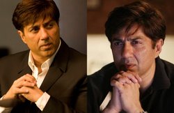 किडनी स्टोन की समस्या से जूझ चुके हैं Sunny Deol, आप इन तरीकों से कर सकते हैं अपना बचाव