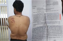 मुस्लिम कैदी की पीठ पर गर्म लोहे से लिख दिया ‘ॐ’, दो दिन खाने भी नहीं दिया, जेल सुपरिटेंडेंट पर आरोप