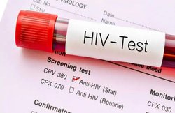 जानिए HIV से पॉर्न इंडस्ट्री कैसे करती है अपने स्टार्स का बचाव