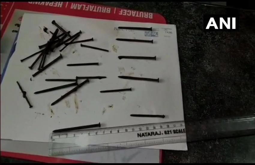 मरीज के पेट से निकलीं कीलें। फोटो सोर्स : एएनआई