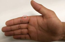 mole in human body, mole in human body, know about red mole, mole meaning, mole significance, mole is good or bad, what mole means, mole benefits, samudr shastra, mole what predict, prediction of red mole, तिलों के बारे में, तिल के बारे में, तिल का महत्व, कैसा होता है तिल, तिल कैसा होता है, how is till, how is mole, is mole is good, importance of mole in human body,