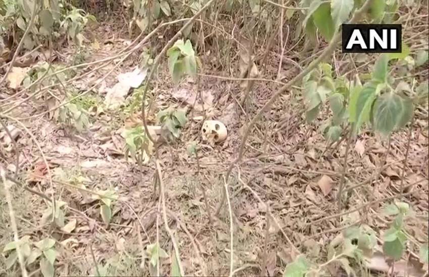 Human skeletal, ri Krishna Hospital, muzaffarpur, muzaffarpur dm, nitish kumar, jdu, rjd, bihar news, chamki bukhar