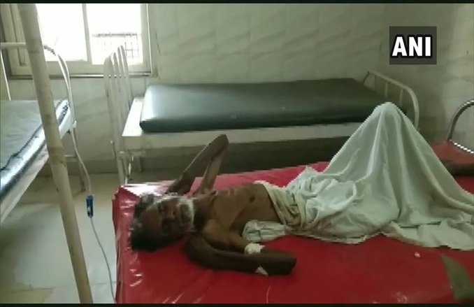 रात में डॉक्टर ने घोषित कर दिया मृत, सुबह पोस्टमार्टम के वक्त ले रहा था सांस, CMO ने बिठाई इन्क्वायरी
