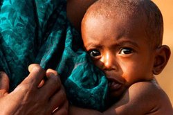 दुनिया से खत्म हो जाएगा कुपोषण, अगर मिल जाएं यह चार बेहद सस्ती चीजें