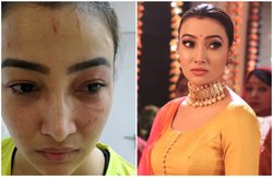 टीवी सीरियल ‘नामकरण’ फेम एक्ट्रेस नलिनी नेगी को रूममेट ने पीटा, केस दर्ज