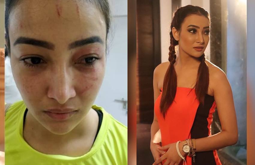 Nalini Negi, Nalini Negi news, Nalini Negi updates Nalini Negi physical assault, Nalini Negi photots, Nalini Negi FIR, Nalini Negi police