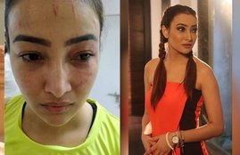 Nalini Negi, Nalini Negi news, Nalini Negi updates Nalini Negi physical assault, Nalini Negi photots, Nalini Negi FIR, Nalini Negi police