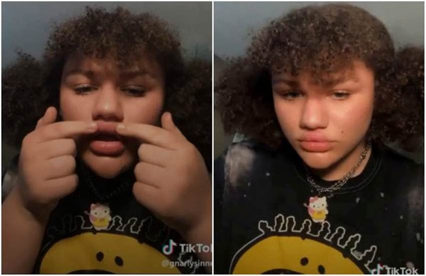 TikTok पर होठों को चिपकाने का ट्रेंड चल रहा है। 