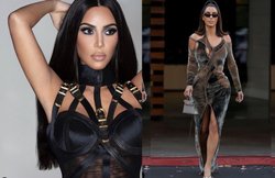 Kim Kardashian को हो गई ल्यूपस नाम की बीमारी, जानिए लक्षण, कारण और ट्रीटमेंट