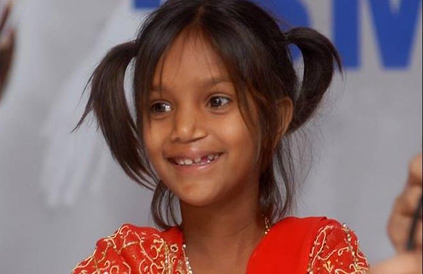 Smile train, FOGSI, Smile Train and Operation Smile, smile train logo, smile train foundation, smile train India, smile train partner hospitals, smile train stories, smile training center