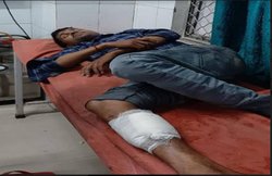 ATM कार्ड बदलकर से करोड़ों रुपए उड़ाने वाले गैंग से पुलिस की मुठभेड़, एक बदमाश के पैर में लगी गोली, बाकी गिरफ्तार