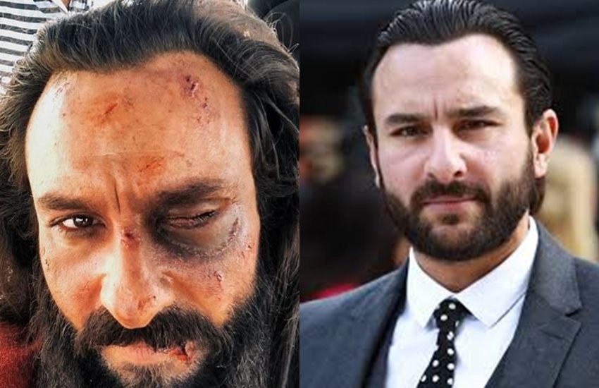 Saif Ali Khan, saif ali khan movie, saif ali khan wifeSaif Ali Khan look Laal Kaptaan character, Saif Ali Khan shooting Laal Kaptaan, Laal Kaptaan, Saif Ali Khan injured, Saif Ali Khan injured photo, Saif Ali Khan Aghori, Saif Ali Khan Dashanan, Navdeep Singh, sets of Laal Kaptaan, Laal Kaptaan character, सैफ अली खान. सैफ अली खान फिल्म लाल कप्तान,
