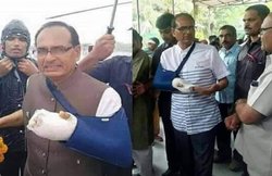 शिवराज की चोट पर कन्फ्यूजनः Flipped फोटो देख लोग बोले- एक्टिंग तो सही से किया करो मामाजी