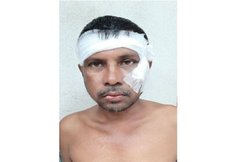 West Bengal: टीएमसी कार्यकर्ता ने लगाया ‘जय श्रीराम’ का नारा, नाराज साथियों ने जमकर पीटा, सिर फोड़ डाला