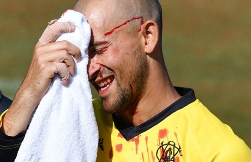 क्रिकेट के दौरान हुआ हादसा (फोटो सोर्स-twitter)