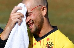 VIDEO: कैच लपकते हुए सिर में लगी गेंद तो लहुलुहान होकर जमीन पर गिर पड़े एश्टन एगर, मैच के दौरान हुआ हादसा