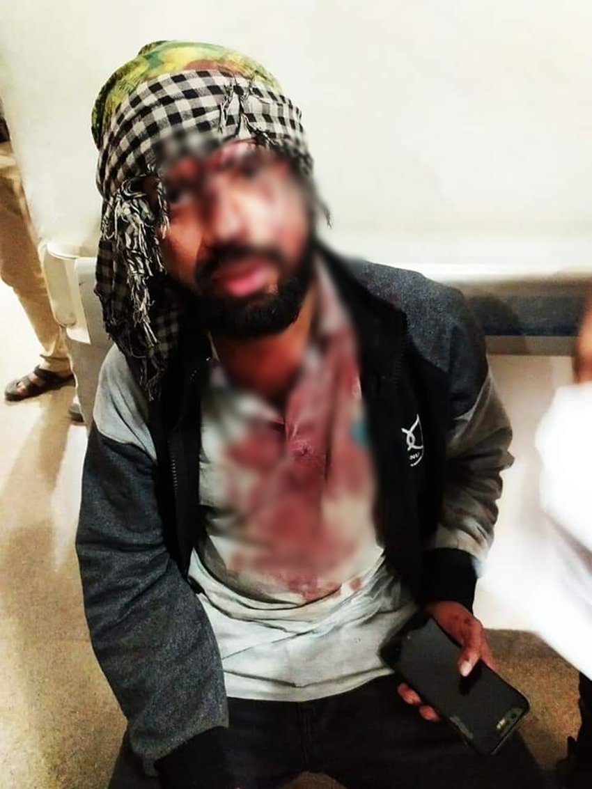 @ratneshh_/twitter नाम के एक यूजर ने इस तस्वीर को शेयर करते हुए लिखा- जेएनयू के छात्र क्या फीसवृद्धि के खिलाफ प्रोटेस्ट भी नहीं कर सकते। ये कैसा लोकतंत्र है।